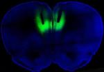 Lasers Inspire Use of Transcranial Magnetic Stimulation to Treat Cocaine Addiction