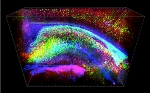 Novel Technique Allows Molecular Analysis of Intact Brain