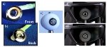 Slim, Telescopic Contact Lens for Patients with Macular Degeneration