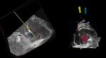 Collaborative Project Develops Image-Guided Oncology Therapy System