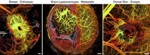 New Optical Imaging Techniques Reveal Cancer’s Inner Workings