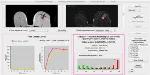 Researchers Develop Computer-Aided Image Analysis for Identifying Specific Tumor Characteristics