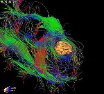 Novel Technique Enables Neurosurgeons to Visualize Brain's Delicate Anatomy
