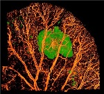 New Optical Imaging Technique Helps Better Understand Facelift Complications