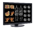 FDA Clears NDS Surgical Imaging’s Dome S6c LED Radiology Display
