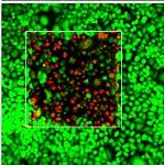 New Technology Could Bring Photodynamic Therapy into Deep Areas of the Body