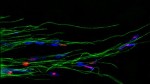 EPFL Scientists Develop Novel Fluorescent Probes Offering Unprecedented Image Resolution