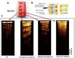 Researchers Integrate Optical Coherence Tomography Device with Epidural Needle