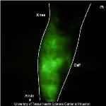Near-Infrared Fluorescence Laser Imaging Enables Quantitative Measurement of Lymphatic Structures and Flow