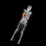 Imaging with Gamma or Neutron Radiation Found to be Safe in Computer Simulations