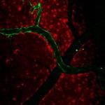 Light, Optics and Imaging Help Identify How Brain Regulates Blood Flow
