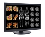 NDS Surgical Imaging Unveils New Dome S6c Widescreen Color 6MP Diagnostic Display