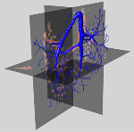 Novel Technology to Digitally Navigate 3D Images