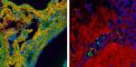 High-Speed BCARS Allows Detailed Mapping of Specific Components of Tissue Samples