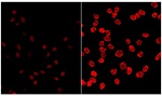 Nonlinear Optical Imaging Shown to Be No More of a Cancer Risk Than Regular Sun Exposure