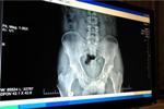 ARiX RAD System Utilizes Radiation Detector for Obtaining X-ray Images