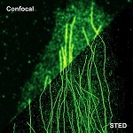 PicoQuant releases STED add-on for the time-resolved confocal microscope MicroTime 200