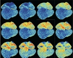 Optogenetic Proteins Help Visualize Developing Heart
