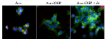 Light-Activated Aptamer Accurately Targets Tumor Tissues