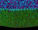 Olympus BioScapes Announces Winners of 2014 Digital Imaging Competition