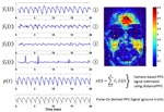 Novel Technique Uses Video Camera to Monitor Blood Volume