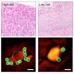 Novel Smartphone-Based Device for Accurate Molecular Diagnosis of Tumors