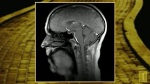 Beckman's BIC Magnetic Resonance Imaging Helps View Dynamic Images of Vocal Movement