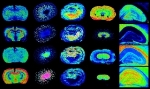 ImaBiotech, GSK to Conduct Pilot Study on Mass Spectrometric Derived Imaging Technology