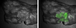 Lung Cancer Fluorescent Imaging During Surgery Using Targeted Molecular Agents May Become a Reality