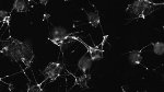 Researchers Use Light to Precisely Manipulate Stem Cell Differentiation