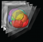 New Non-Invasive Image Processing Technique to Visualise Embryo Formation