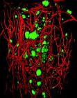 New Method to Make Transparent Tissue for Illuminating 3D Brain Anatomy at Very High Resolutions