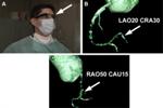 Cardiologists Treat Chronically Blocked Right Coronary Artery Using Virtual Reality Device