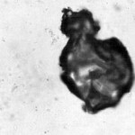 Ultrafast 3D Imaging System Helps Investigate Effects of Microcavitation Bubbles on Traumatic Brain Injury