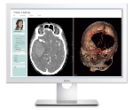 Dell Releases Medical Monitor Purpose-Built for the Healthcare Environment