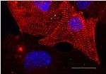 MIPT Scientists Control Behavior of Heart Muscle Cells Using Laser Radiation