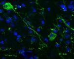 Optogenetics Could Help Treat Fear-Related Diseases