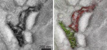 Researchers Describe New Form of Multicolor EM to Simultaneously Visualize Multiple Molecular Species