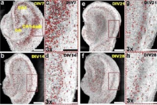 Space-Division Multiplexing Optical Coherence Tomography Could Potentially Map the Brain Using Light
