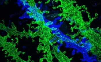 Tissue Expansion Enables Use of Traditional Microscopes for High-Resolution Imaging