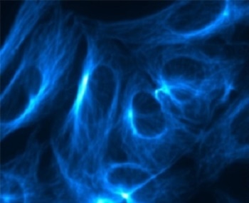 SRRF-Stream - Andor Launches the World’s First Super-Resolution Microscopy Camera
