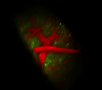Deceptively Simple SCAPE 4D Microscope brings Major Innovation to Live Cell and Whole Animal Imaging