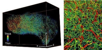 Assessing Cancer Stage Using Innovative Three-Dimensional Microscopy Technique