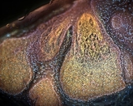 UV Microscope Serves as Powerful Diagnostic Tool in Patient Care and Medical Research