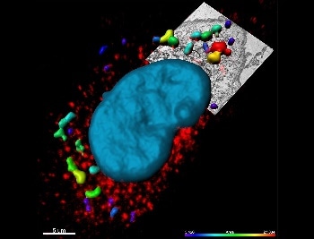Solutions for Correlative Microscopy and the Introduction of Imaris Stitcher