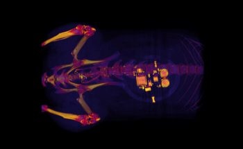 Researchers Develop New Implantable Device that Uses Light Signals to Treat Bladder Problems