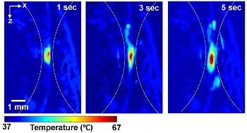 Non-Invasive Imaging Technique Could Significantly Improve Cancer Treatments