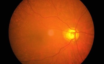 A Revolutionary Imaging Tool Could Make Avoidable Blindness a Thing of the Past