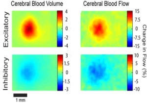 Custom-Built Laser System Reveals Cells that Play a Role in Brain Disorders