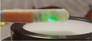 New Photoacoustic Endoscopy Could Lead to Targeted Treatments for Crohn’s Disease
